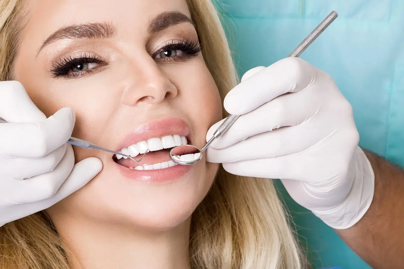 Porcelain Veneers in Montville, NJ