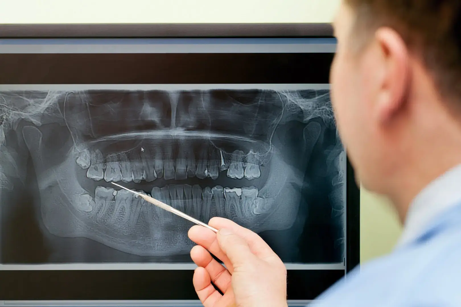 Dental Radiology