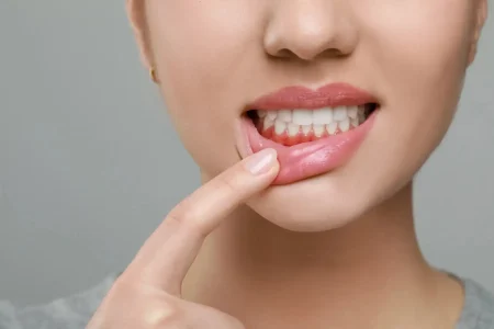 Gum Disease Treatment in Montville, NJ That Protects Your Smile Gum Disease Treatment in Montville, NJ