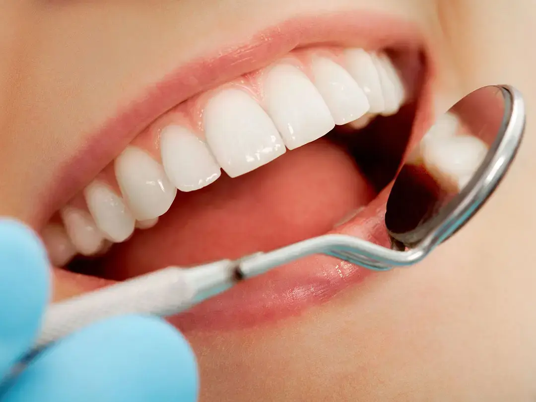 Can Cosmetic Dentistry Improve Your Smile While Preserving Your Natural Teeth?
